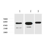 β-tubulin Monoclonal Antibody