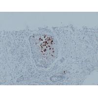 Mammaglobin A+B Monoclonal Antibody PT0163