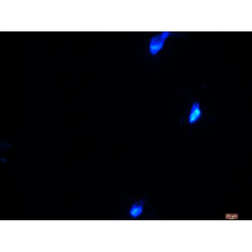 95-D 人肺癌高转株
