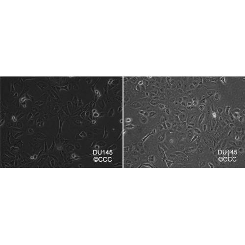 DU 145 人前列腺癌细胞