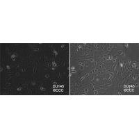 DU 145 人前列腺癌细胞