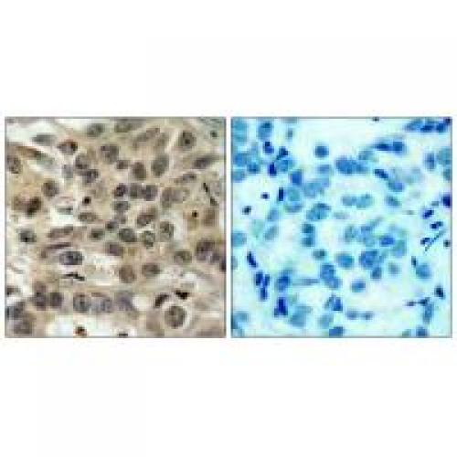 Cdc25C Polyclonal Antibody