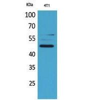 AACT Polyclonal Antibody