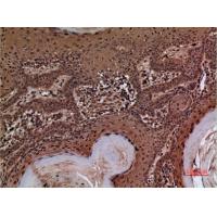 AACT Polyclonal Antibody
