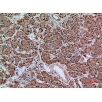 AACT Polyclonal Antibody