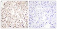Akt Polyclonal Antibody