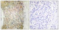 HSP20 Polyclonal Antibody