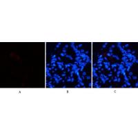 HSP70 Polyclonal Antibody