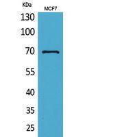 HSP70 Polyclonal Antibody
