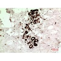 HSP70 Polyclonal Antibody
