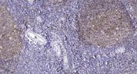 Claudin-5 Polyclonal Antibody