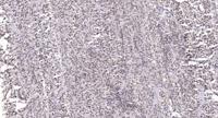 SRp20 Polyclonal Antibody