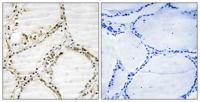 SRp75 Polyclonal Antibody