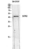 SSTR2 Polyclonal Antibody