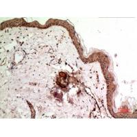 SSX Polyclonal Antibody