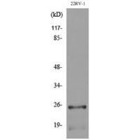 SSX Polyclonal Antibody