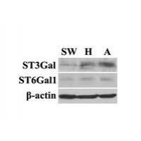 ST6GAL1 Polyclonal Antibody