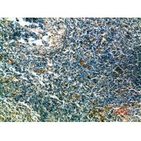 ST6GAL1 Polyclonal Antibody