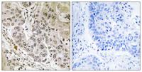 STK36 Polyclonal Antibody