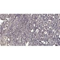 Stra8 Polyclonal Antibody