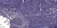 ADAMTS-16 Polyclonal Antibody