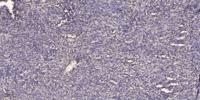 SUHW1 Polyclonal Antibody