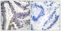 ICAD Polyclonal Antibody