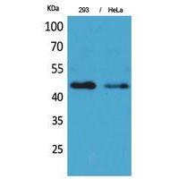 IDH1 Polyclonal Antibody