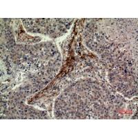 IDH1 Polyclonal Antibody