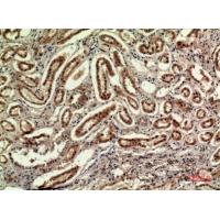 IDH1 Polyclonal Antibody