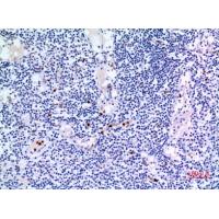 IDH3A Polyclonal Antibody