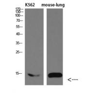 I-FABP Polyclonal Antibody