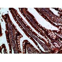 I-FABP Polyclonal Antibody