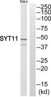 Synaptotagmin XI Polyclonal Antibody