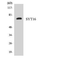 Synaptotagmin XVI Polyclonal Antibody
