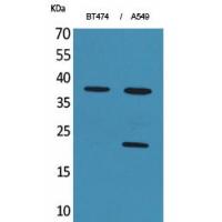 IFN-α1 Polyclonal Antibody
