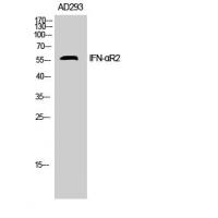 IFN-αR2 Polyclonal Antibody