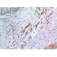 IFN-αR2 Polyclonal Antibody