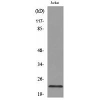 IFN-ε Polyclonal Antibody