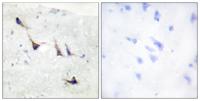 Syntaxin 1 Polyclonal Antibody