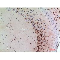 Synuclein-α Polyclonal Antibody