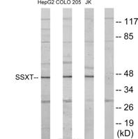 SYT Polyclonal Antibody