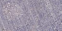 SYT Polyclonal Antibody