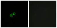 T1R3 Polyclonal Antibody