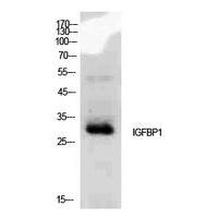 IGFBP1 Polyclonal Antibody
