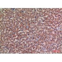 IGFBP1 Polyclonal Antibody