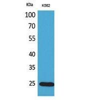 IGFBP6 Polyclonal Antibody