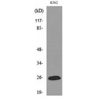 IGFBP6 Polyclonal Antibody