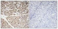 IGF-I Polyclonal Antibody