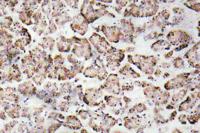 IGF-I Polyclonal Antibody